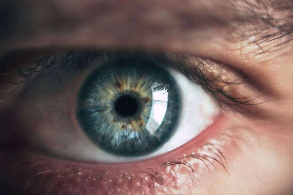 Miopie si astigmatism-pupila
