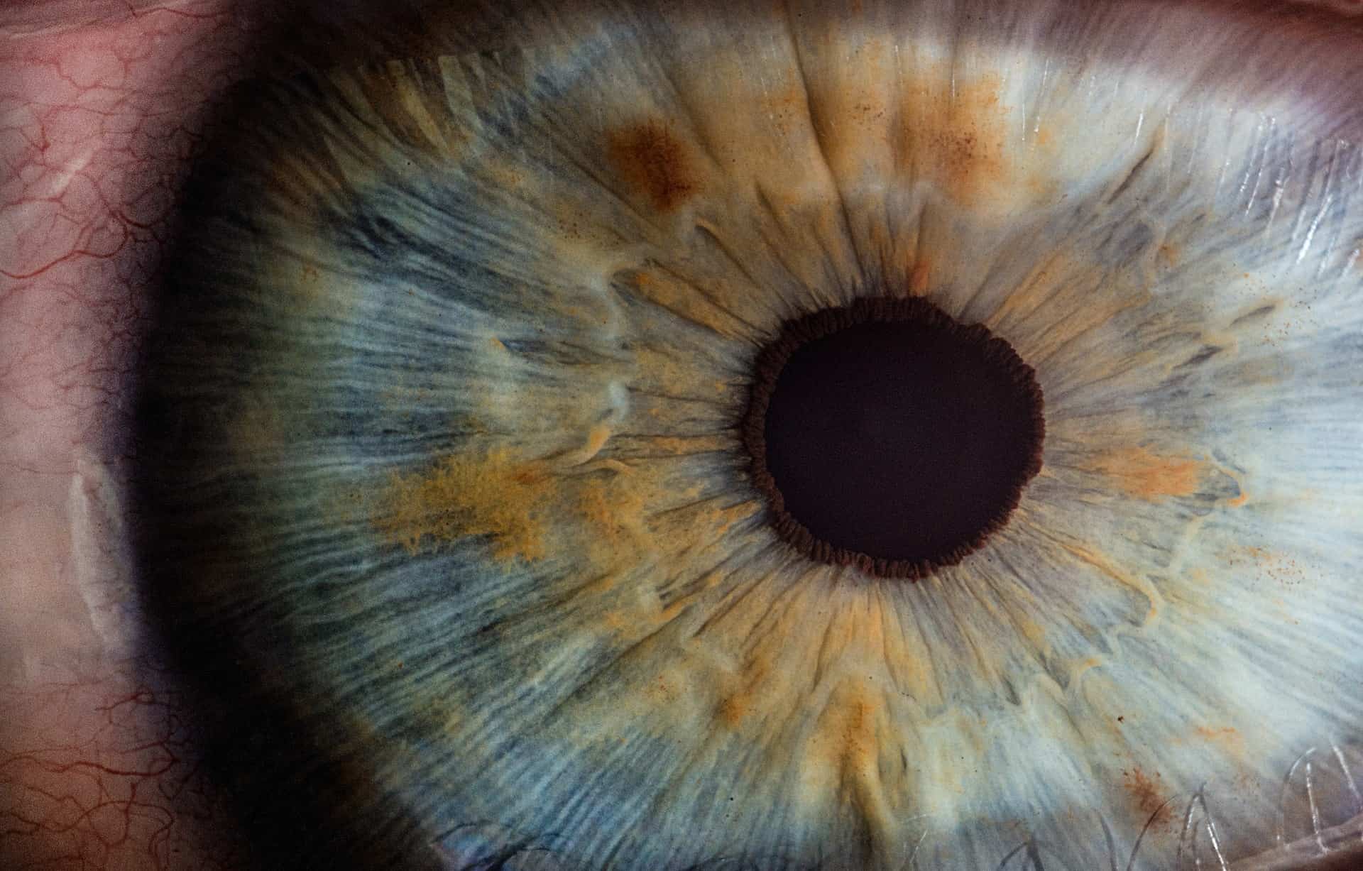 topografie corneana - iris